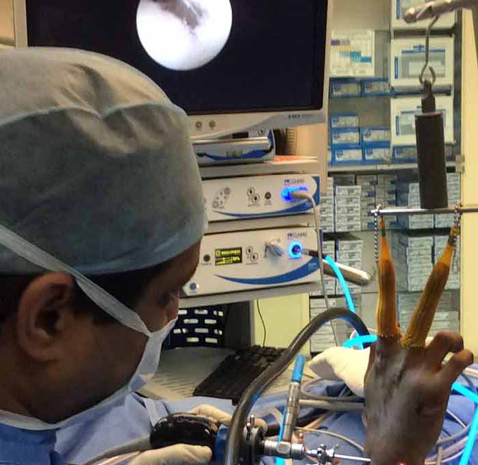 18000+ complex hand surgeries.