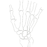 Hand Condition & Treatments